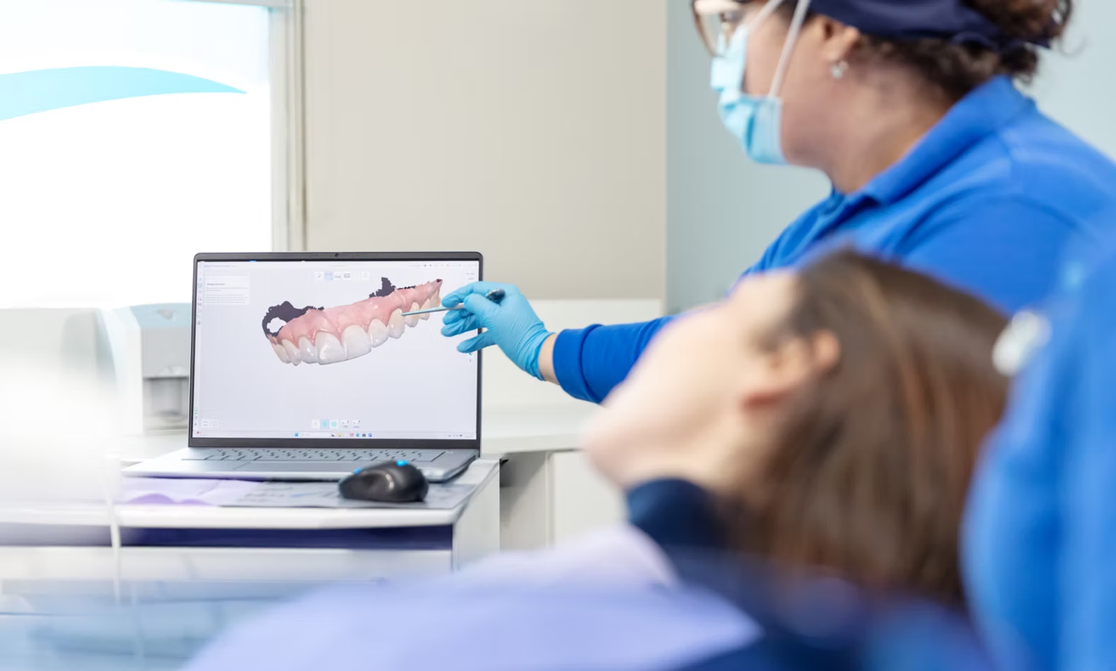 Scansione digitale dell'arcata dentale